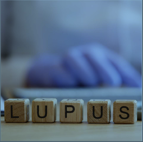 Lupus Study Image